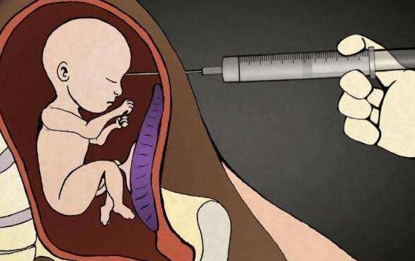 怎样避免因人工流产导致的不孕？做泰国试管能解决这一问题吗？